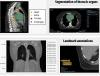 IDC Team Demonstrates the Value of AI in Generating Imaging Annotations Clinical Images